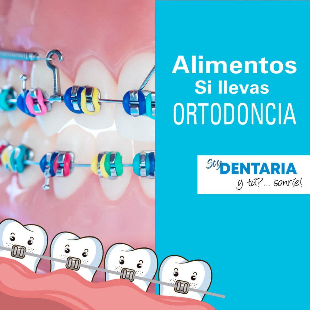 comidas con ortodoncia