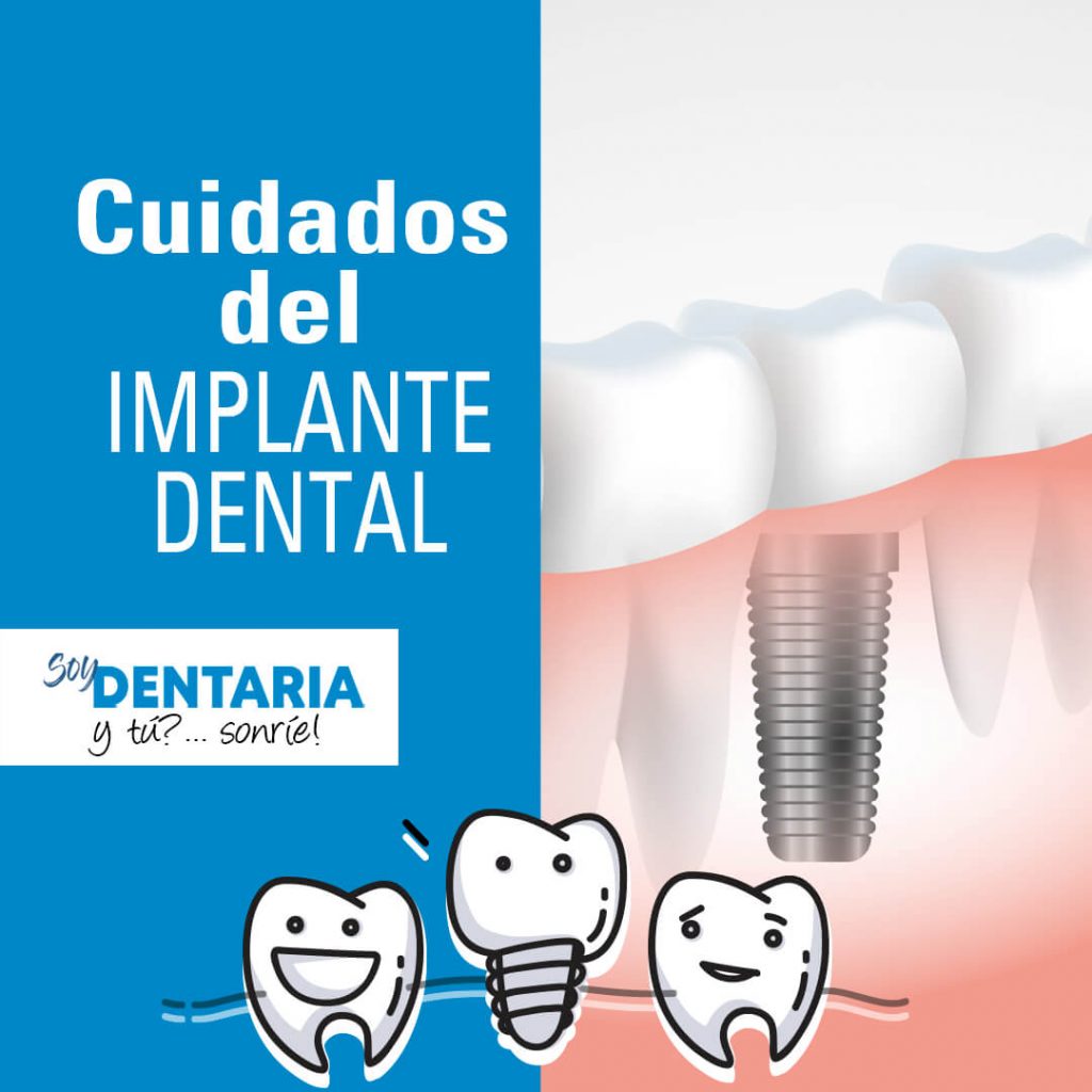 Cuidados de implantes dentales
