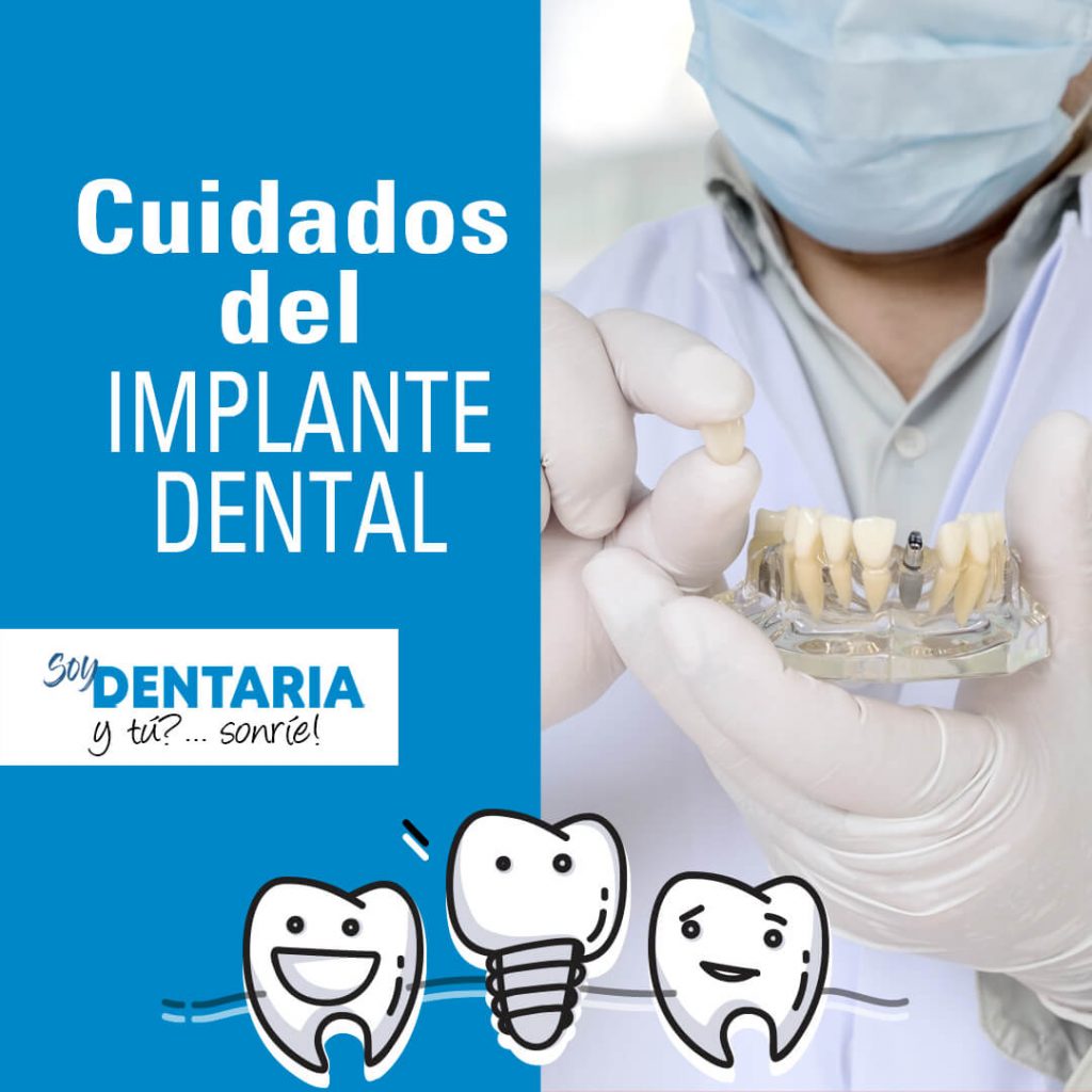 Cuidados de los implantes dentales