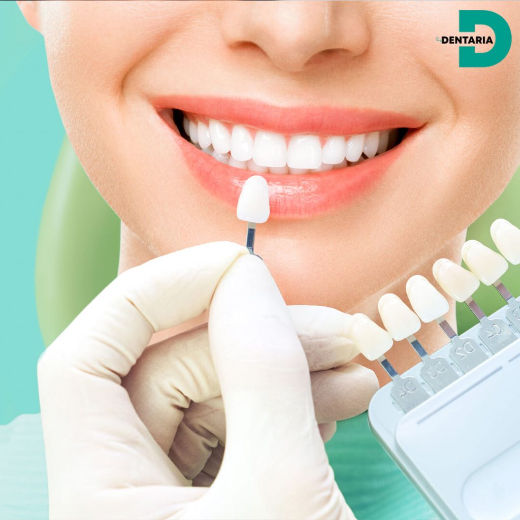 CONSEJOS PARA RECOMENDAR UN BLANQUEAMIENTO DENTAL