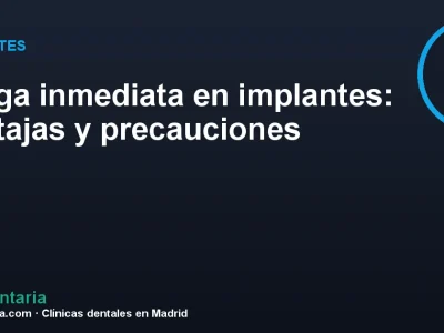 Carga inmediata en implantes: ventajas y precauciones