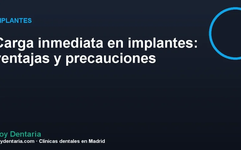 Carga inmediata en implantes: ventajas y precauciones