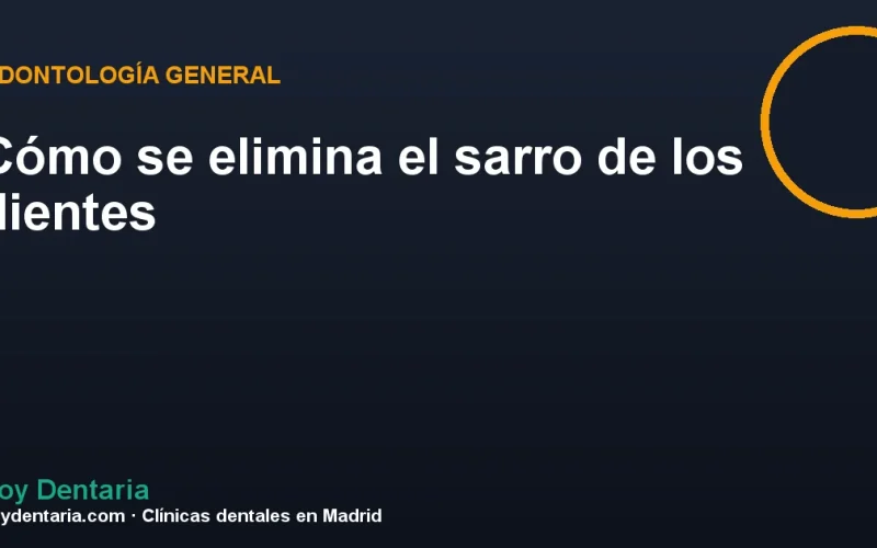 Cómo se elimina el sarro de los dientes