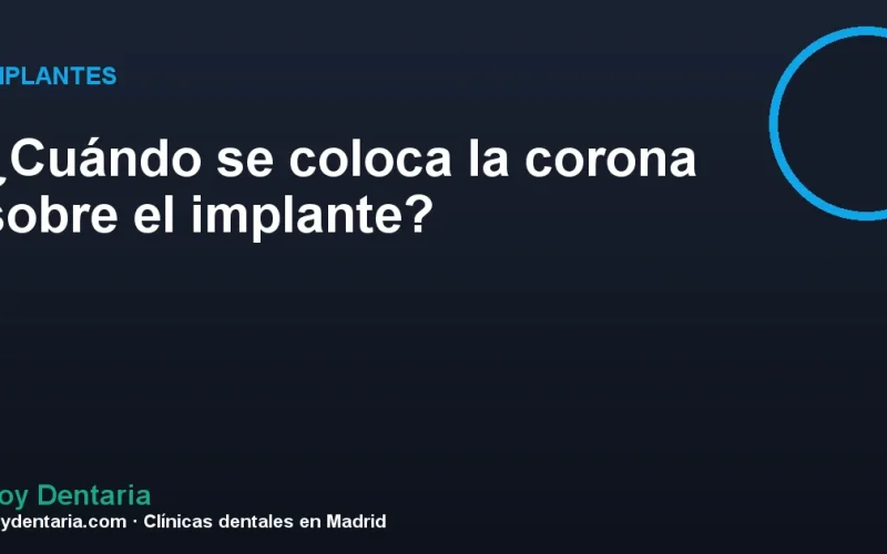 ¿Cuándo se coloca la corona sobre el implante?