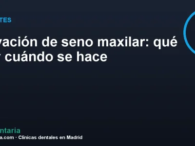 Elevación de seno maxilar: qué es y cuándo se hace