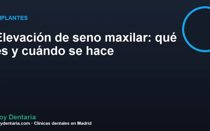 Elevación de seno maxilar: qué es y cuándo se hace