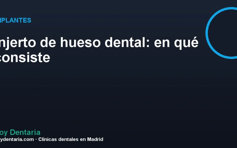 Injerto de hueso dental: en qué consiste