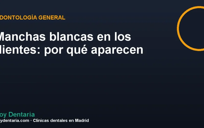 Manchas blancas en los dientes: por qué aparecen