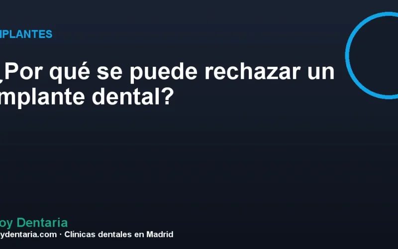¿Por qué se puede rechazar un implante dental?