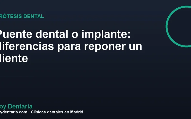 Puente dental o implante: diferencias para reponer un diente
