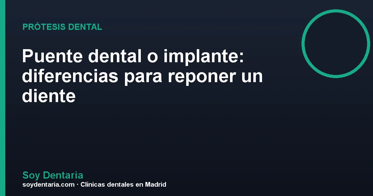 Puente dental o implante: diferencias para reponer un diente