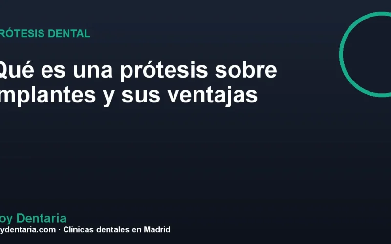 Qué es una prótesis sobre implantes y sus ventajas