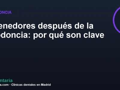 Retenedores después de la ortodoncia: por qué son clave