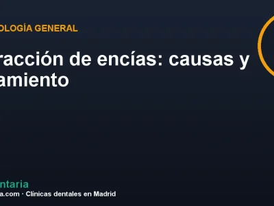 Retracción de encías: causas y tratamiento