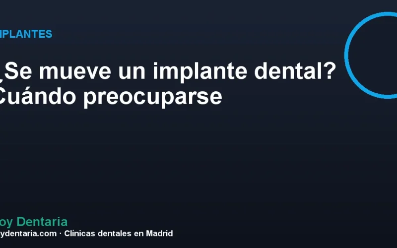 ¿Se mueve un implante dental? Cuándo preocuparse