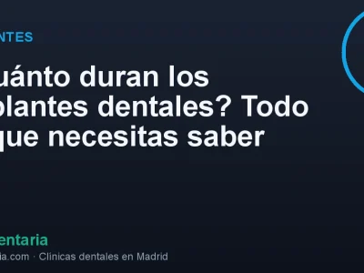 ¿Cuánto duran los implantes dentales? Todo lo que necesitas saber
